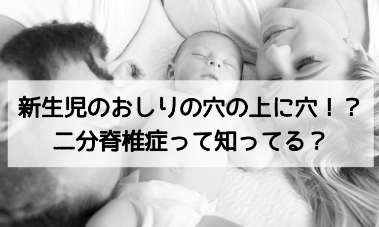 隠れ二分脊椎の治療